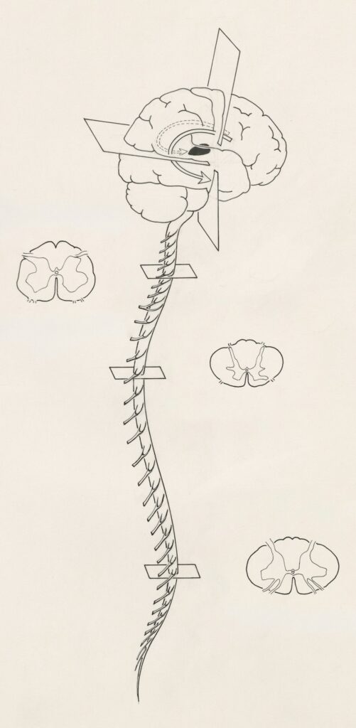 A healthcare educator shows a diagram of the human nervous system to a group of adults in a classroom setting.