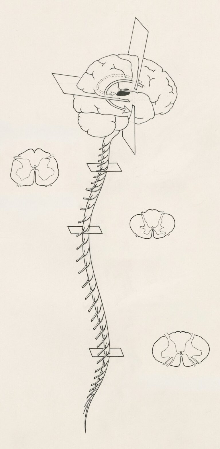 A healthcare educator shows a diagram of the human nervous system to a group of adults in a classroom setting.